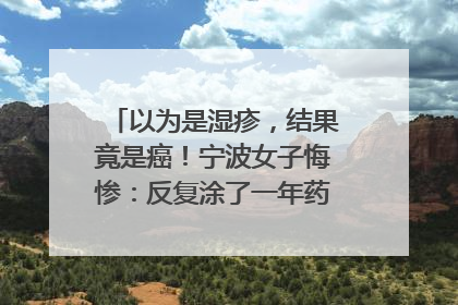 以为是湿疹，结果竟是癌！宁波女子悔惨：反复涂了一年药膏都没好！很多患者首诊都去了皮肤科